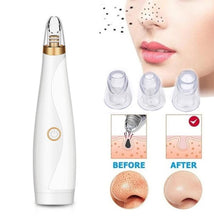 Load image into Gallery viewer, Effective Black Head Cleaner ABS Acne cleaner Fast Blackhead Removal Equipment Cosmetic Instrument White Beauty Device