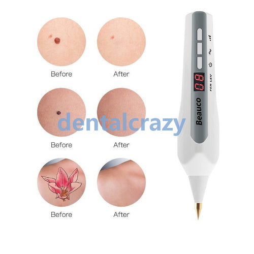 Face Beauty Equipment Laser spot Freckle Tattoo Skin Spots Remove Mole Wart Dark Spot Facial Beauty Plasma Pen