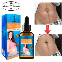 Load image into Gallery viewer, Stretch Marks Remover Essential Oil Skin Care Treatment Cream For Stretch Mark Removal Maternity Slackline For Pregnant Oils