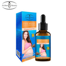 Load image into Gallery viewer, Stretch Marks Remover Essential Oil Skin Care Treatment Cream For Stretch Mark Removal Maternity Slackline For Pregnant Oils